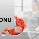 Yutulabilir Mide Balonu Fiyat: 2025’te Nelere Göre Değişir?