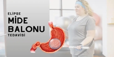 Yutulabilir Mide Balonu Fiyat: 2025’te Nelere Göre Değişir?