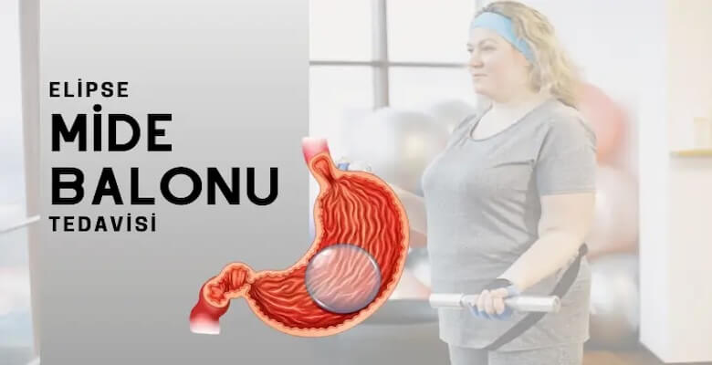 Yutulabilir Mide Balonu Fiyat: 2025’te Nelere Göre Değişir?