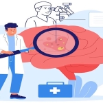 Beyin Tümörü Ameliyatlarında Mikroskop Kullanımı: Modern Cerrahinin Gözleri