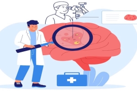 Beyin Tümörü Ameliyatlarında Mikroskop Kullanımı: Modern Cerrahinin Gözleri