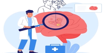 Beyin Tümörü Ameliyatlarında Mikroskop Kullanımı: Modern Cerrahinin Gözleri