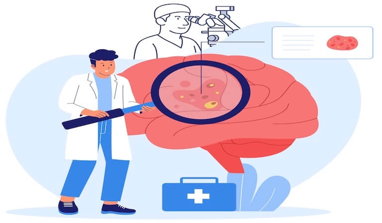 Beyin Tümörü Ameliyatlarında Mikroskop Kullanımı: Modern Cerrahinin Gözleri