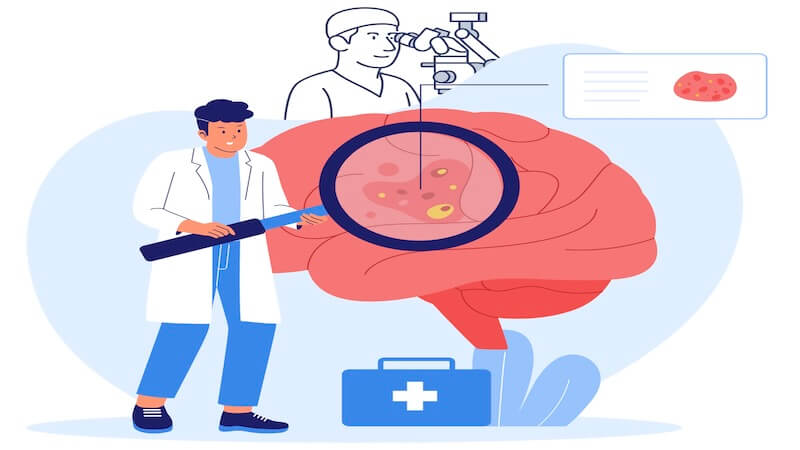 Beyin Tümörü Ameliyatlarında Mikroskop Kullanımı: Modern Cerrahinin Gözleri