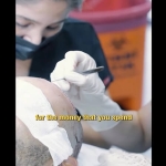 Hair Transplant Antalya – Haarex Clinic