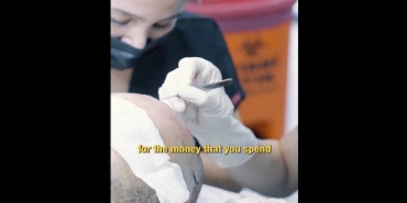 Hair Transplant Antalya – Haarex Clinic