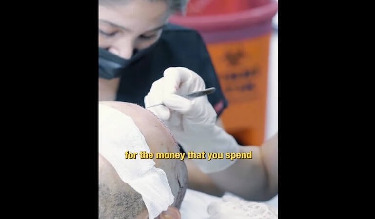 Hair Transplant Antalya – Haarex Clinic