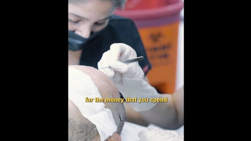 Hair Transplant Antalya – Haarex Clinic